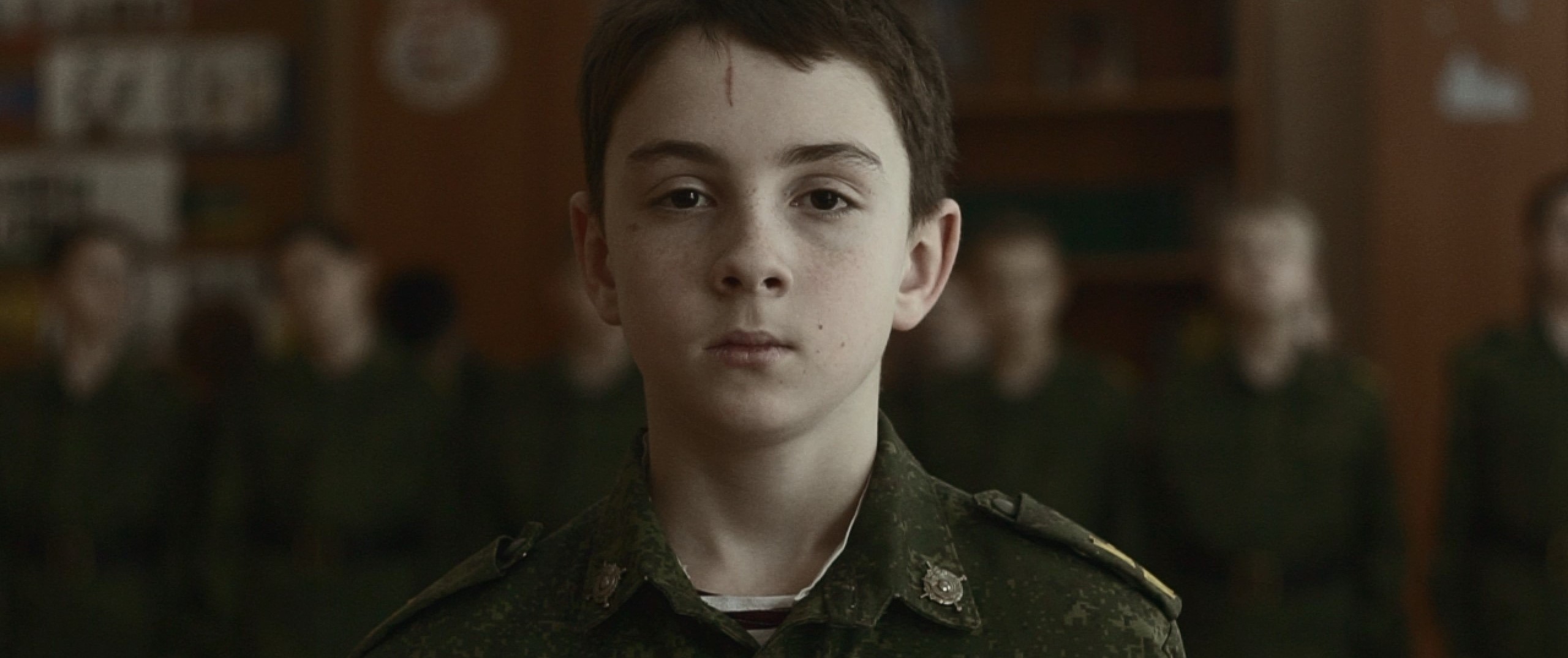 Young boy with scar on his forehead stares into camera, wearing a uniform